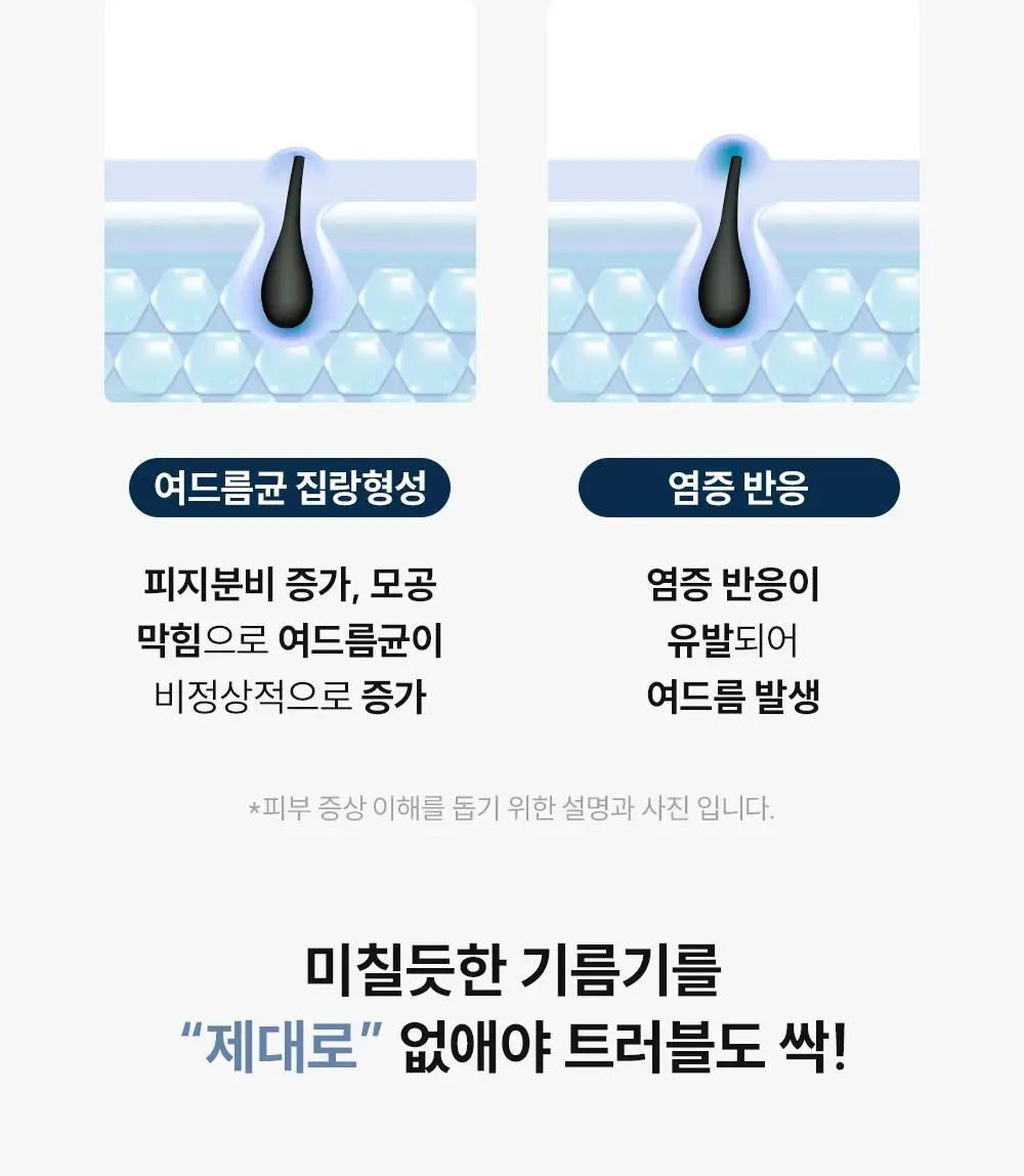 [등드름/체취케어] 낫포유 지성피부전용 등드름/가드름 클리어 바디미스트 포맨 200ml 상세페이지 7